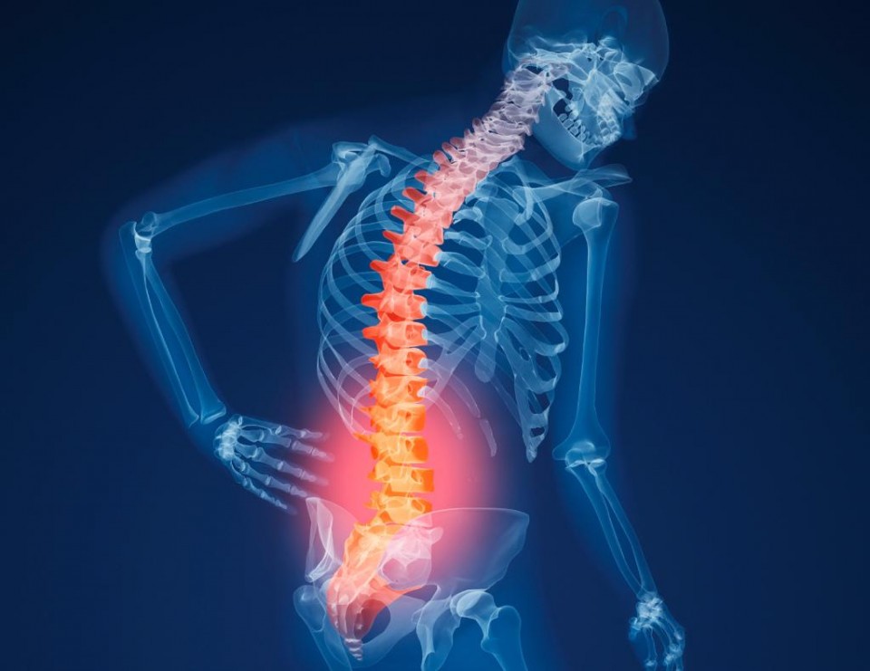 ¿Qué es la osteoporosis?